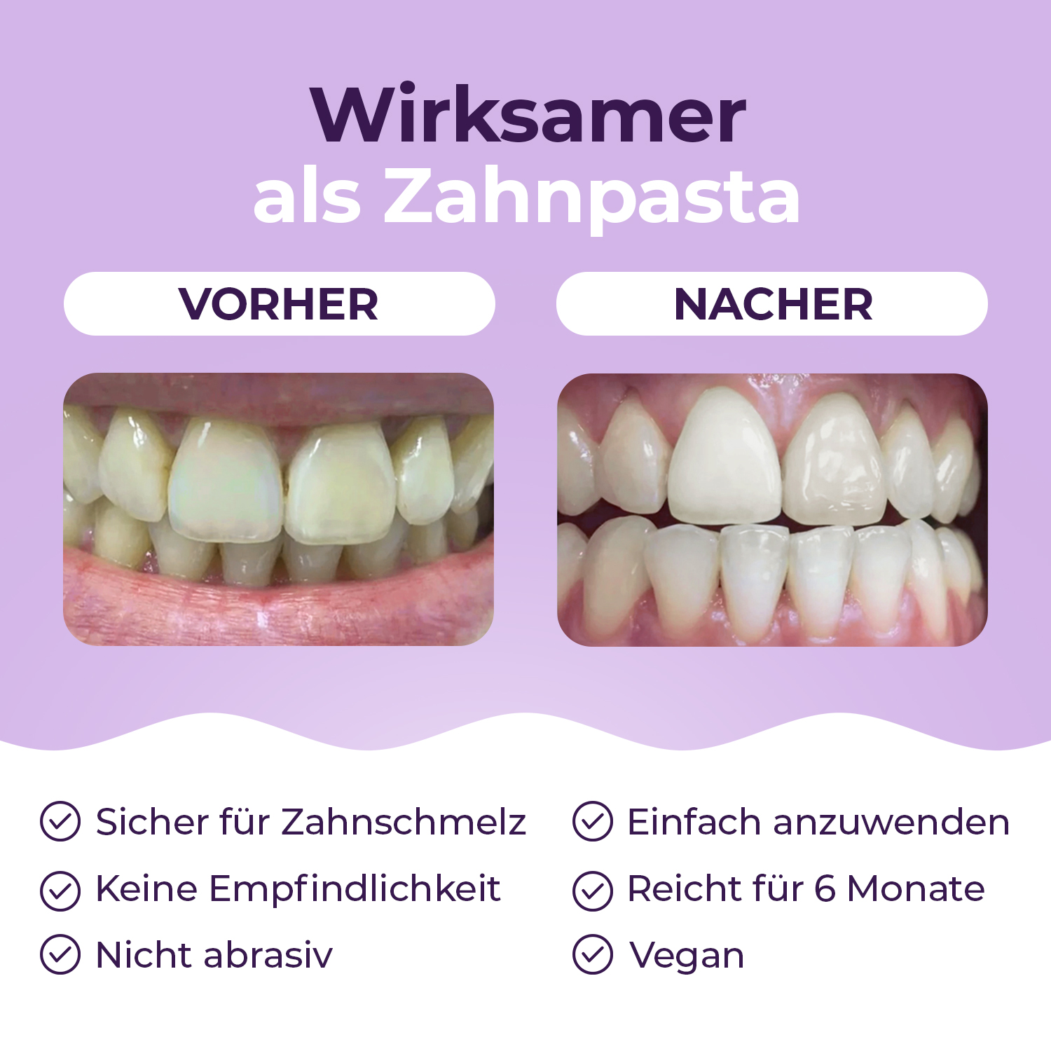 OnlySmile® polvere sbiancante per denti